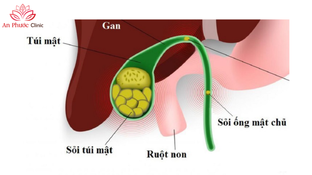 Vị trí tổng quan của túi mật