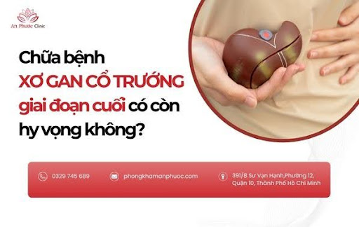 Chữa bệnh xơ gan cổ trướng giai đoạn cuối có còn hy vọng không?