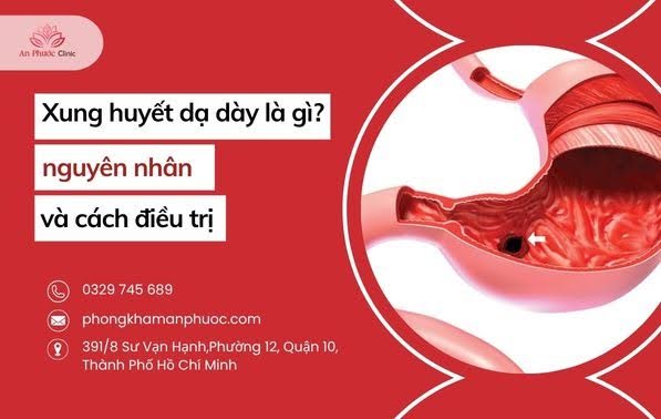 Xung huyết dạ dày là gì? Nguyên nhân và cách điều trị